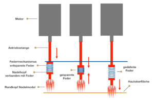 Rundkopf-Needler indirekte Kraftübertragung durch Federmechanismus